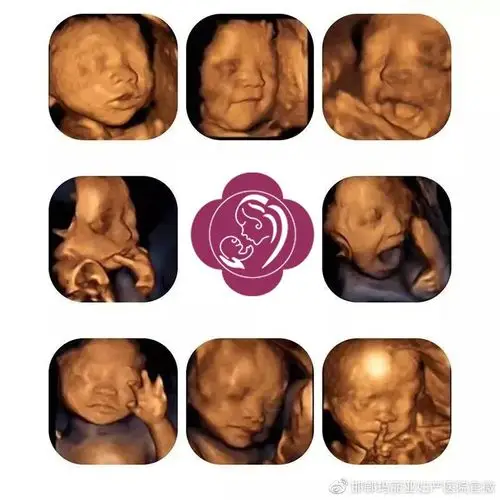 咦,为什么我的四维图像没有别人的清晰?