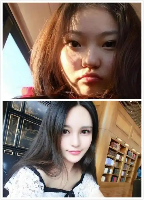 如果像周扬青这样从一坨肥肉成功整成一枚芭比混血