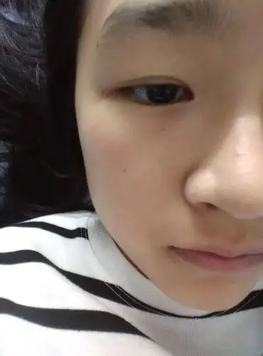 角质层比较薄的皮肤应该怎样护理?