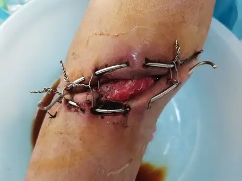 凡事感恩的美篇