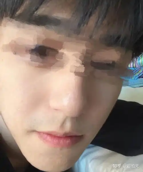 毛孔粗大痘痘黑头多大油脸怎么办4步解决皮肤问题3个月养成细腻肌肤