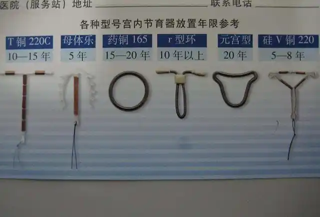 宝妈想取掉节育环生二胎,却被医生告知:已错过最佳"取环"时间