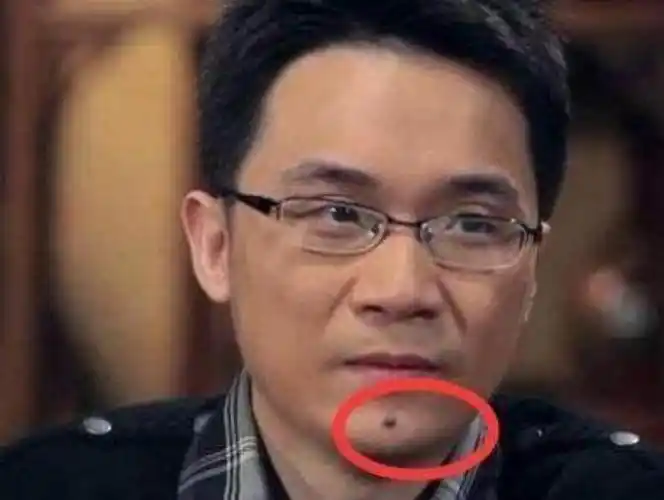 下巴左有痣好不好(下巴左面长痣的位置代表什么)