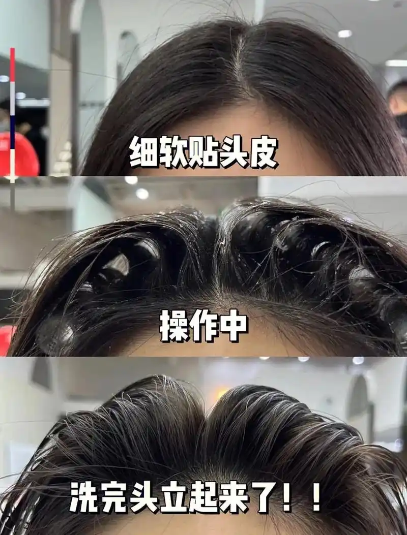 发根烫发教程颅顶增高