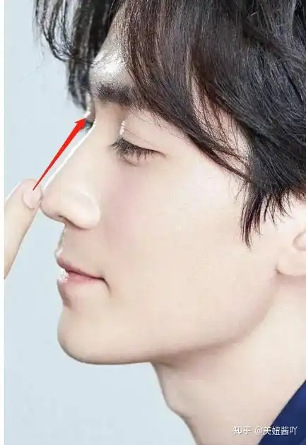 4.鼻梁侧面线条(鼻型的选择)