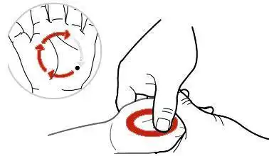 取穴:手掌面以掌心内劳宫为圆心,内劳宫到中指根中外1/3交界处为半径