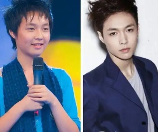 【图】张艺兴整容前后照片对比吓人 网友称认不出