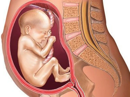 【臀位lsa是什么意思】臀位lsa代表什么意思_胎位lsa是什么意思