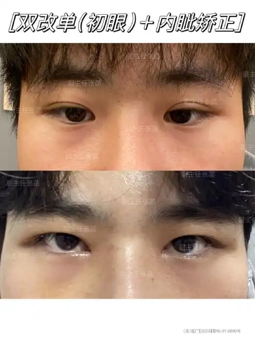 不再以大眼睛双眼皮为美的标准,更多的人选择找到自己独特的风格  双