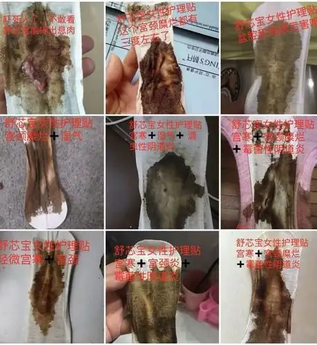 诱发妇科炎症的原因是什么?怎么预防?