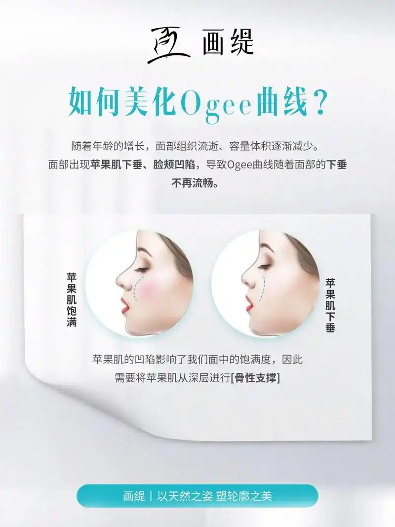 78ogee曲线,面部重要的美学曲线之一.7878ogee曲线 17 - 抖音