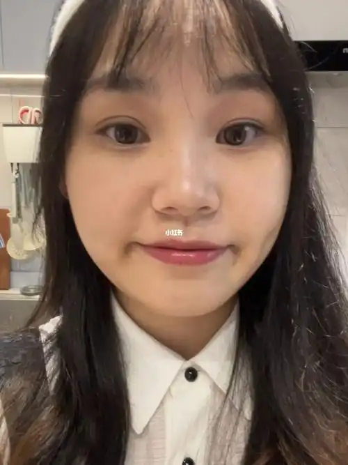 高发际线 圆脸  比无效化妆还无效化妆