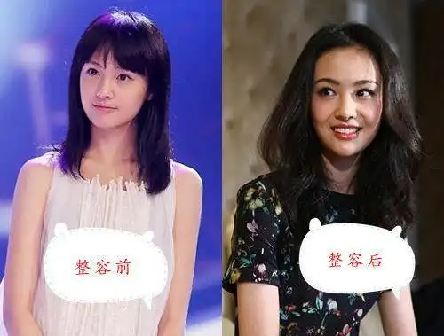 名单直言杨幂李冰冰赵丽颖等8位女星整容不怕被告明星电影文章小虾米