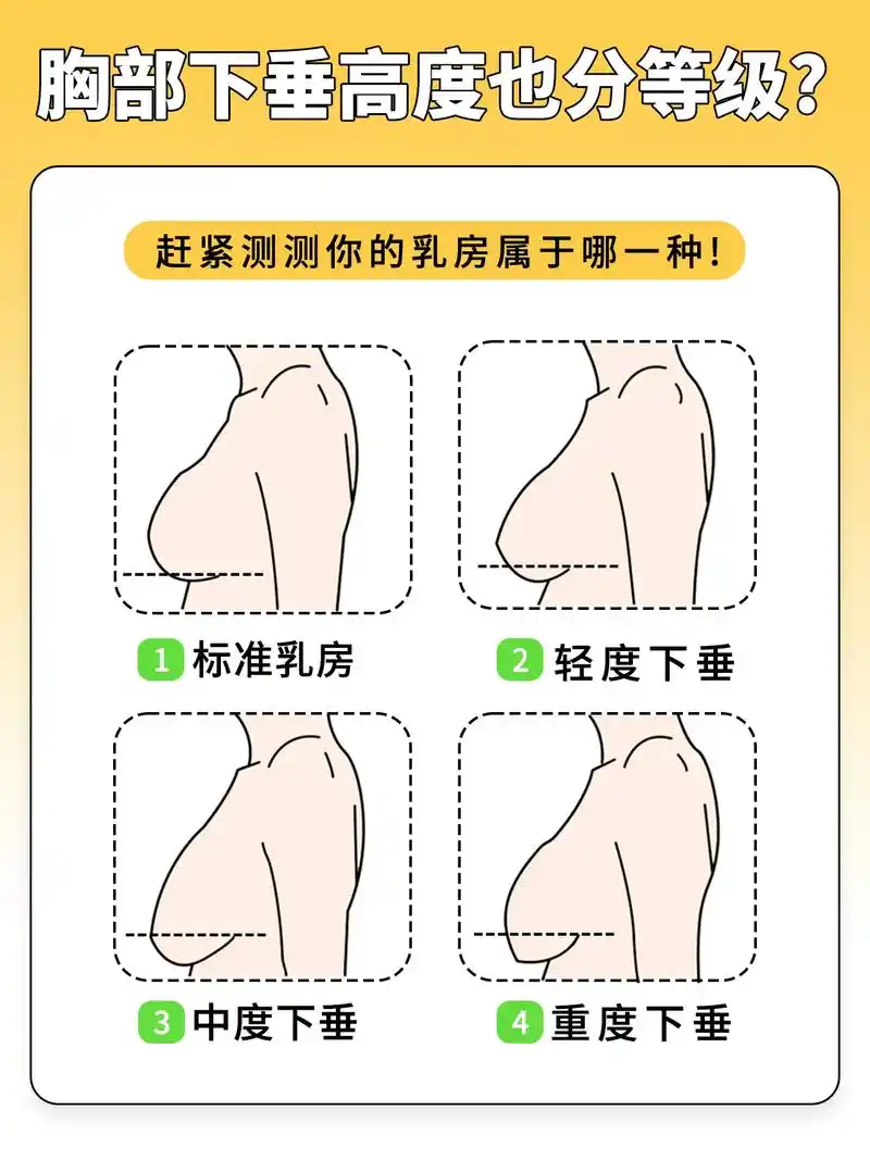 什么?胸下垂还有等级之分?快 - 抖音