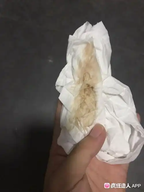 上厕所,擦出褐色分泌物,是例假吗?
