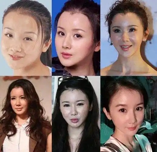 小知识!柳岩整容前后"和风细雨"