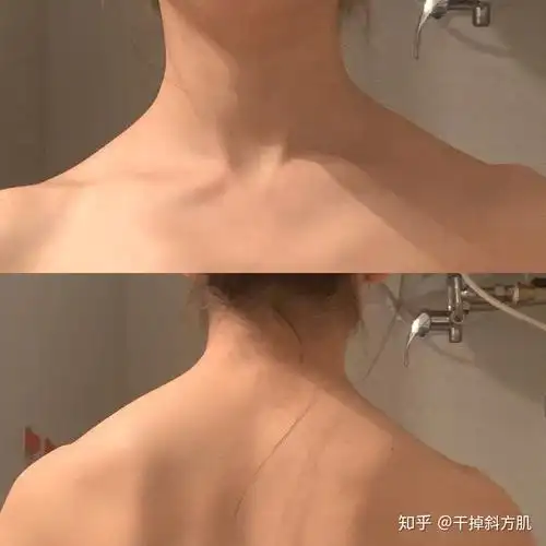 来看看我的斜方肌