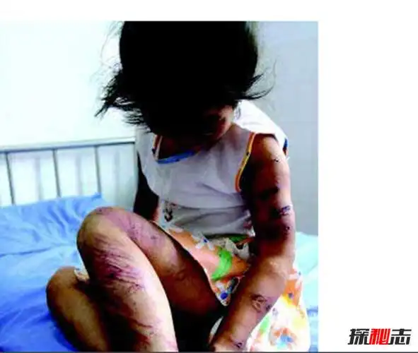 小苏丽验尸照片(死后遭亲生母亲扒坟)