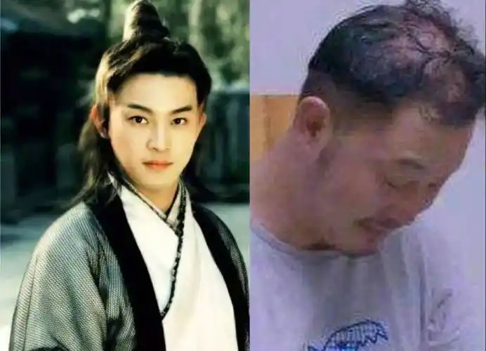 胡歌发际线堪比吴彦祖,何炅头发稀疏能见头皮_假发_沙溢_网友