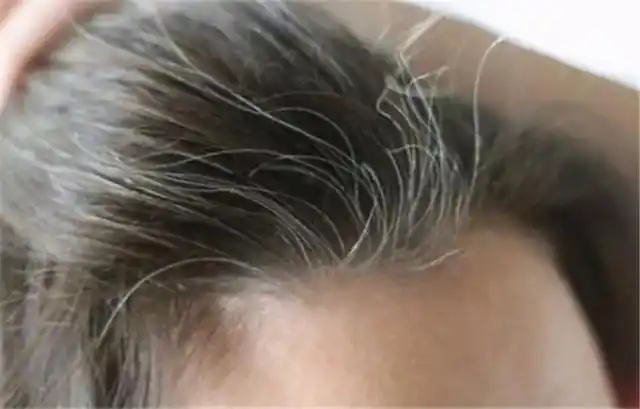 明明很年轻为什么白头发越长越多真的会拔一根长十根吗