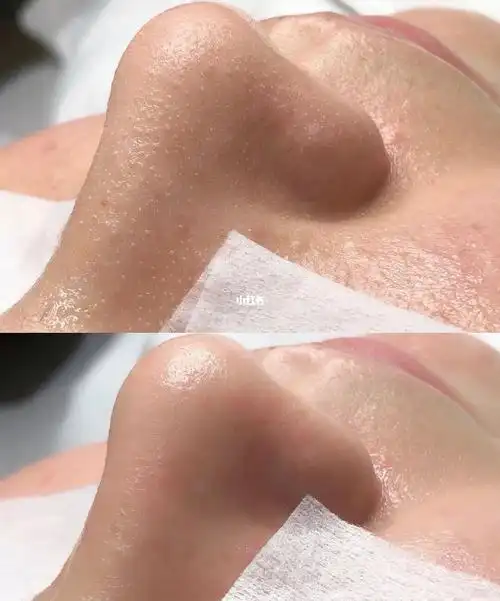 为什么做深层清洁0371