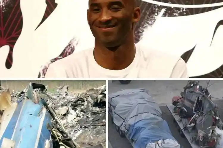 原创心疼nba科比医学修复图公布胳膊断了腿也没了瓦妮莎签字