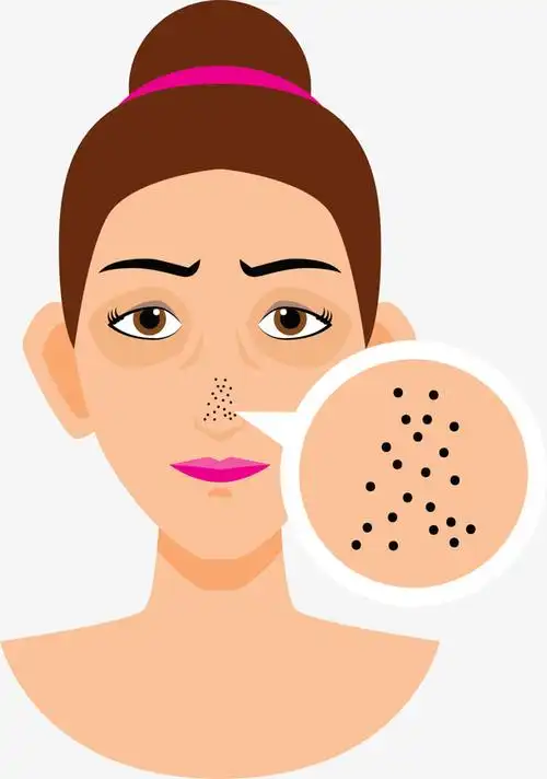 卡通黑头烦恼女人