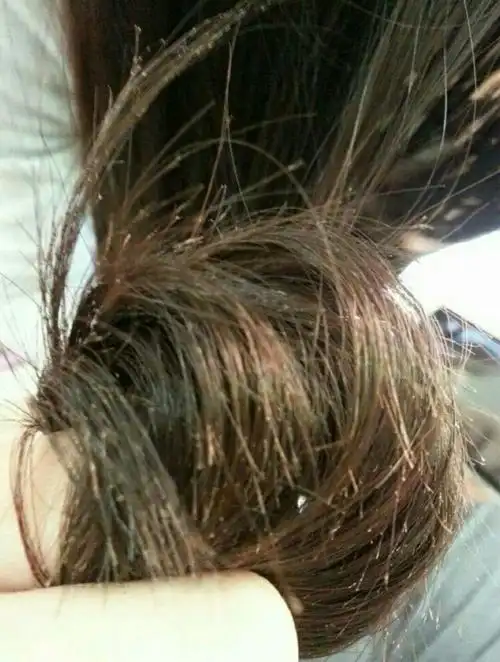 对抗受损发丝有妙招——丝丝亮发超级洗护修复9度受损发质