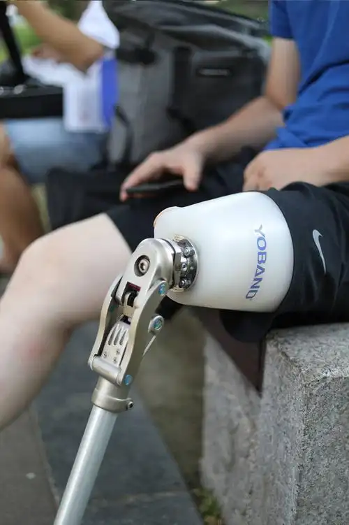 大腿假肢的装配中,经常发现有大腿截肢患者穿戴假肢后出现残肢末端的