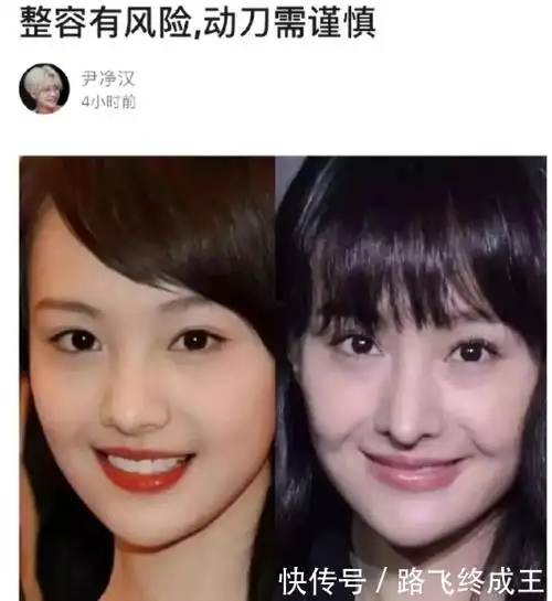 女大十八变?郑爽早期照片与近照对比,鼻子和下巴变化较大