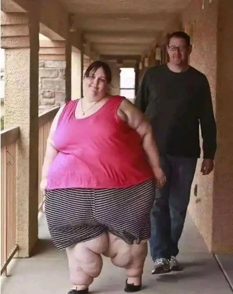 世界上最胖的女人!