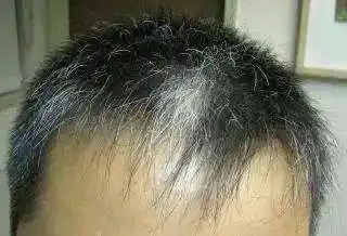 后脑勺白发锅盖发型男(短发发型男生16种图片)-图1