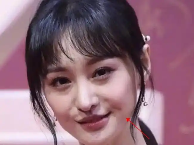 明星的外貌缺陷,杨紫的法令纹,刘亦菲的牙肉,她的缺陷令人羡慕