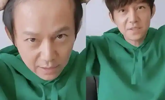 有种"整容"叫人到中年!周杰伦,黄晓明依赖假发,沙溢即将秃顶