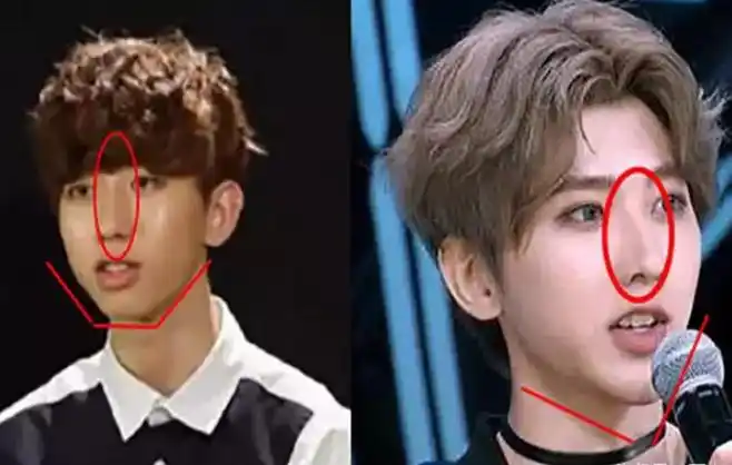 蔡徐坤成名前照片曝光,在韩国双膝下跪太卑微,整容前后容貌大变