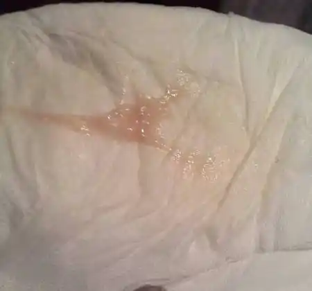 月经干净后三天 小腹闷痛 白带粉色 像带血 是回经吗?