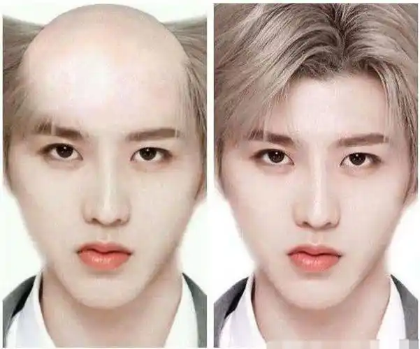 有一种岁月叫"秃头",蔡徐坤难逃此劫,张艺兴中招,而李易峰