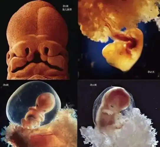 10月胎儿形成全过程8张图带你了解真相感受生命的奇迹