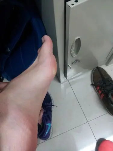 踢球磨脚,在前脚掌内侧,除了多踢,怎么解决这个问题(解决再加悬赏)_百