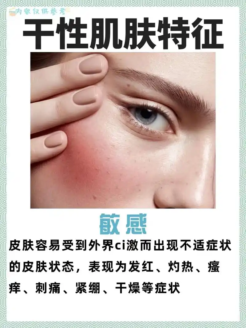 改善敏感肌肤特征需要长期的保养和护理,包括温和 - 抖音