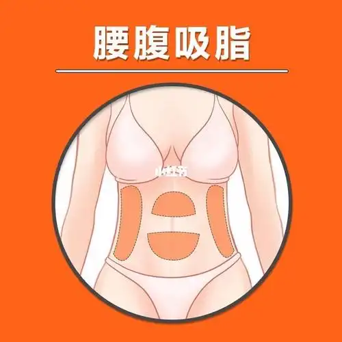 塑形部位大揭秘,这些部位千万不要吸脂_吸脂_塑形_环吸_腿部塑形_双