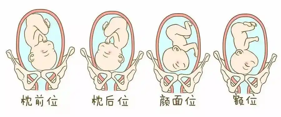 胎膜早破可导致早产率升高,胎儿病死率增加,宫内感染率及产褥感染率均