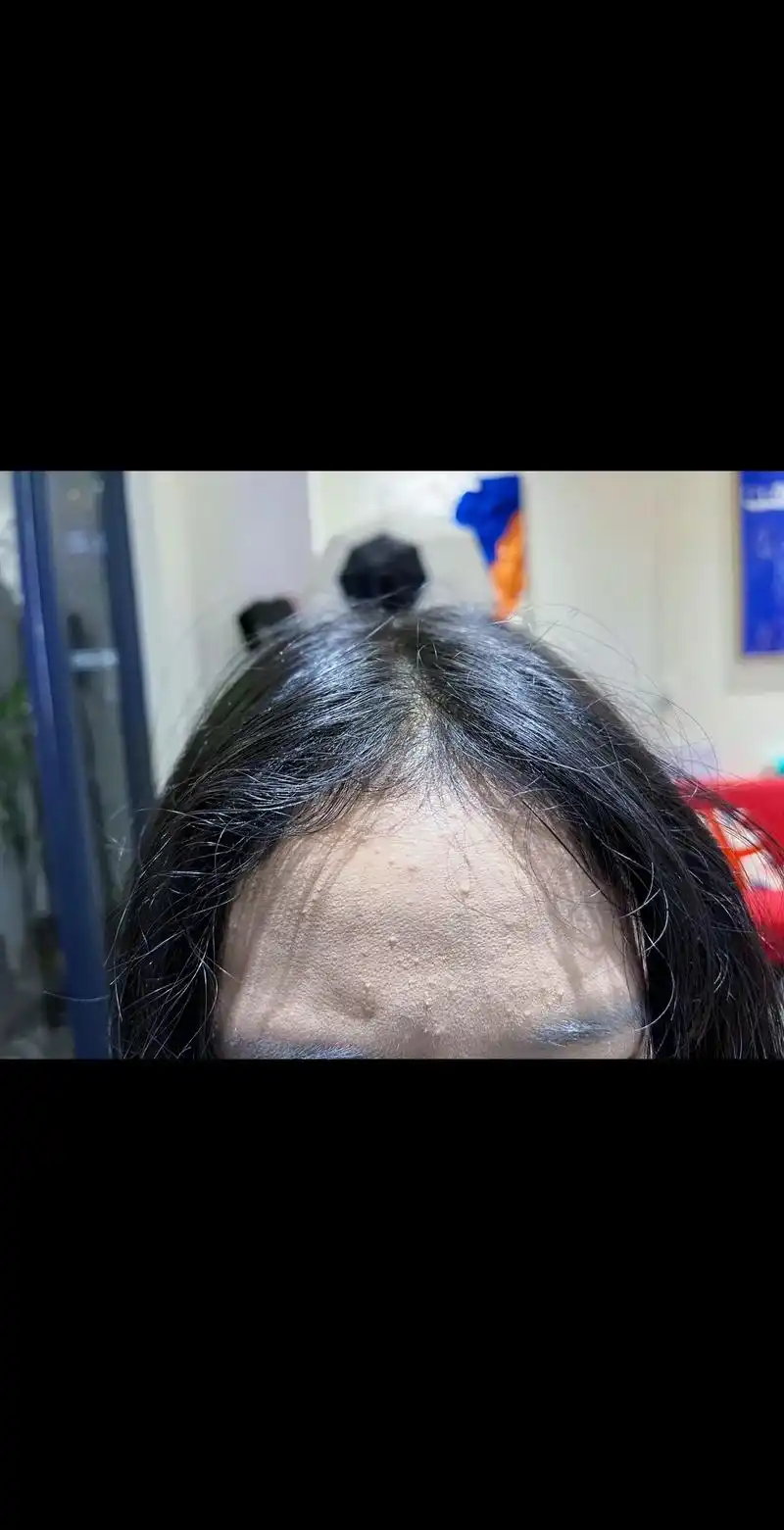 摩根气垫烫 针对头顶比较服帖的 通过73头顶发根蓬松可 - 抖音