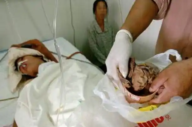 40岁妇女去取避孕环,当医生准备给她检查时,医生立刻选择报警-奇闻录