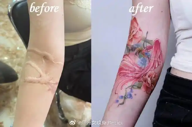 纹身恢复  再也不許有人不知道紋身可以遮蓋疤痕哦  看到照片上她回到
