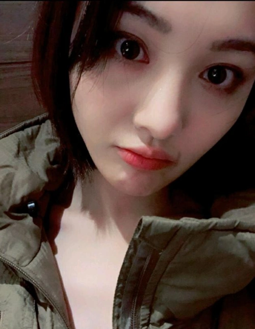 郑爽晒自拍少女感十足 嘴角伤痕引人瞩目