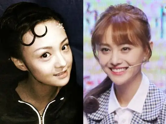 郑爽苹果脸和锥子脸对比