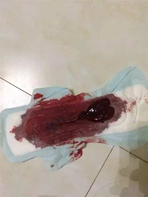 来月经量多_偸拍mm来月经图片_偸拍学女来月经图_女人来月经流血过程