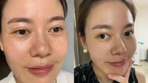 淡斑祛斑效果排名第一,分享:祛斑口碑最好的十大品牌|美白|色斑|保湿