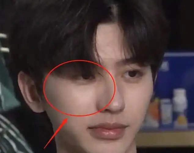 蔡徐坤素颜穿睡衣上节目摘掉眼镜后21岁的皮肤状态是认真的